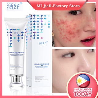 Han Yu Whitening Moisturizing Cream Acne Essence 30g Face Essence Cream Scar Acne Treatment Serum