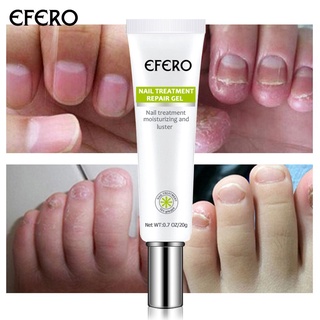EFERO Nail Fungus Serum Anti-fungal Nail Serum Nail Fungus Removal Toe Moisturizing and Shining Hand and Foot Skin Care (1)