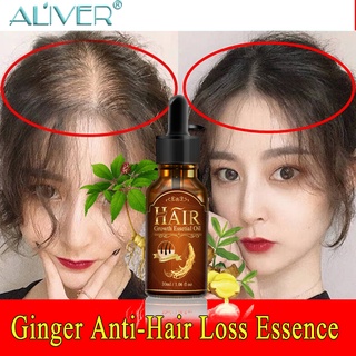 Aliver Ginseng Hair Growth Liquid Nourishing Anti Hair Loss Boosting Fast Hair Growth Serum Oil 30ml (1)