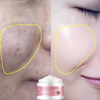 AUTHENTIC Japan Sakura Skin Care Set Whitening Set Exfoliating Shrink pores Acne and Pimple Treatmen (7)