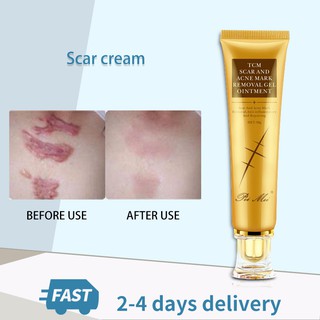 Scar cream remove old scars acne skin repair scar gel skin repair