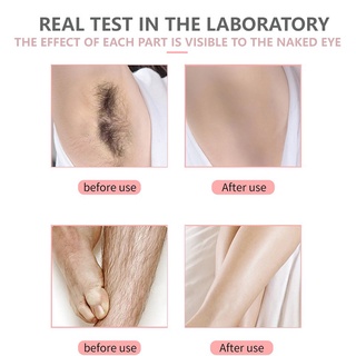 HEMEIEL-hair removal cream, underarm hair removal, leg hair removal cream, hair growth inhibitor (3)