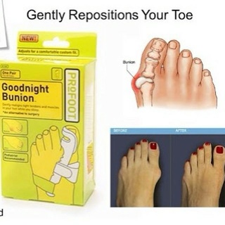 Goodnight bunion for foot