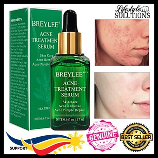 BREYLEE Acne Treatment Serum [LuiSa PH] Essence Anti Acne Scar Removal Cream Whitening Repair Pimple (1)