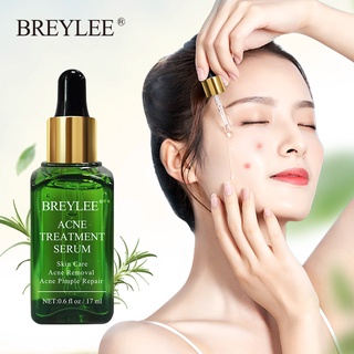 BREYLEE Acne Removal Treatment Serum Face Cream Oil Control Cream Shrink Pores Moisturizing Face (2)