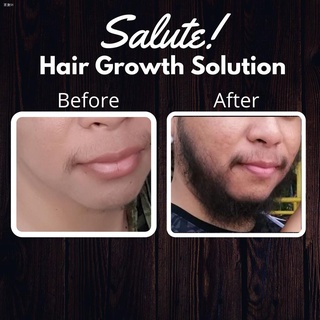 Bagong produkto✿Hair Grower Minoxidil 5% Solution SPRAY by Salute! for men and women (50mL) (3)