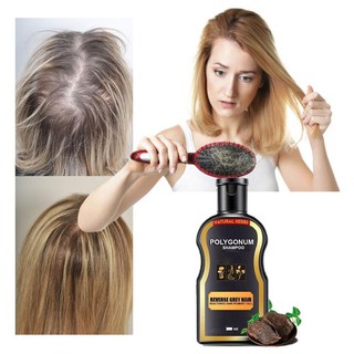 Hair Loss Treatment Shampoo Hair care Shampoo Hair Growth Anti-hair Loss Shampoo (3)