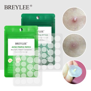 BREYLEE Acne Pimple Patch Acne Treatment Stickers Pimple Remover Tool Blemish Spot Facial Water proof