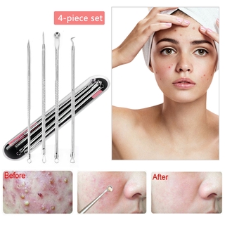 4pcs Blackhead Remover Extractor Removal Tool Tweezers Kit Stainless Facial Acne Spot Pimple tool