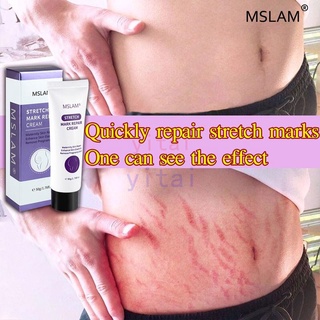 2021new✠❆MSLAM Stretch mark cream for Stretch Marks Pregnancy cream Scar Stretch Marks Stretch Marks