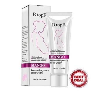 Rtopr Mango Remove Pregnancy Scars Acne Cream Stretch Treatment Marks Mater T6H1
