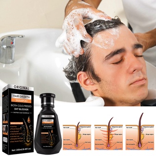 Professional Ginger shampoo Anti-Hair Loss Shampoo hair Treatment hair growth Hair Care Essence