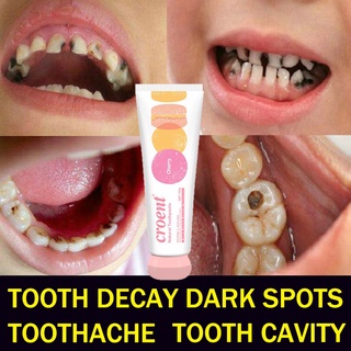 Anti-decay toothpaste quick repair filling fresh breath toothpaste healthy mouth 100g
