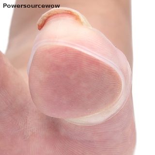 Powersourcewow Silicone Ingrown Toenail Correction Tool Invisible Ingrown Toe Nail Treatment PH