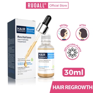 RUOALL Men's 15% Hair Growth Treatment 30ML 50g
