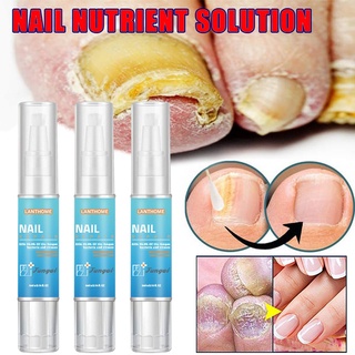 YOUNGCOME Nail Fungal Treatment Nail Repair Essence Serum Remove Onychomycosis Toe Foot Care Liquid
