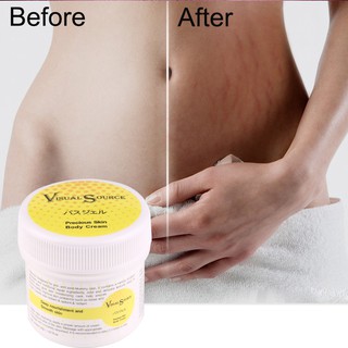 Skin Body Maternity Cream stretch marks remover scar removal