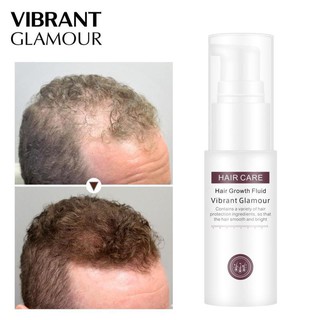 VIBRANT GLAMOUR Hair Growth Spray Essence revent Hair Loss Preventing Baldness Consolidate Essence (1)
