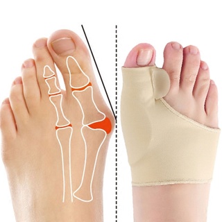 ◕✌☂1Pair Toe Corrector Orthotics Feet Foot Care Bone Thumb Adjuster Correction Soft Pedicure Socks