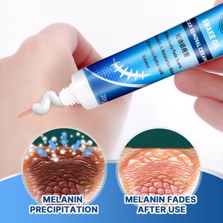 【Sumifun】 Scar Remover Old Scar Gel Cream Acne Treatment Whitening Moisturizer Serum Skin Care (7)