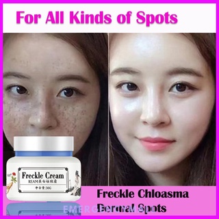 Melasma Dark Spot Remover Freckle Cream Face Spots Body Lotion Elbow Hands Under Eyes Spot Removal