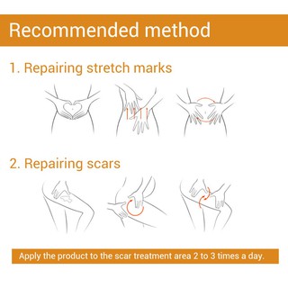 LANBENA Acne Scar Remove Serum Acne Treatment Remover Stretch Marks Anti Acne Blackhead (3)