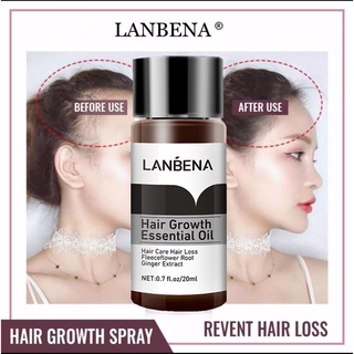 Lanbena hair grower for men for women hair growth serum castor oil care (1)