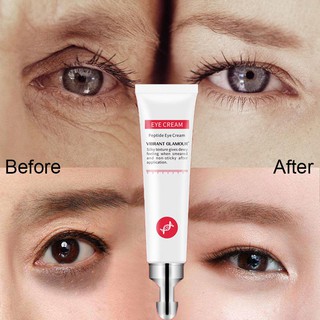 Eye Cream Anti-Blu-ray ANR Repair Eye Cream Anti-Wrinkle Collagen Serum Anti-Age Remover Dark Circle