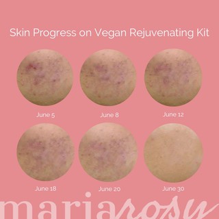 Mariarosy Vegan Rejuvenating Facial Kit (Minimal Redness& Peeling) (7)