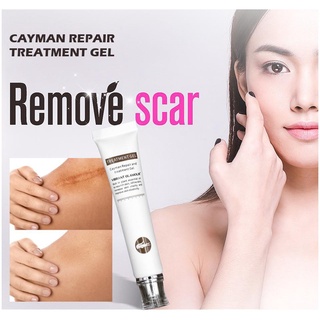 【Ready Stock】✜✟▦VG Scar Remover Acne Scar remover Cream Scars Repair Stretch Marks Pregnancy Scars S