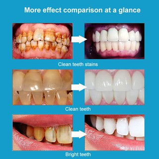 Teeth Whitening Whitening Teeth Products Perfect Smile Teeth Whitening Pen Tooth Gel Whitener (6)