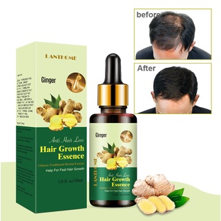 Hair Loss Treatment Hair Loss Shampoo Prevent Hair Loss Product Hair Growth Essential Serum Oil Sham (4)