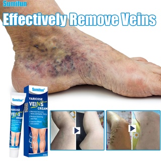 SUMIFUN Varicose Veins Cream Varicose Vein Remover Cream(Relieve Swelling/lmprove Blood Circulation)