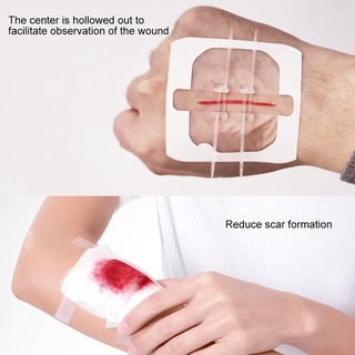 Zipper Band-aid Painless Wound Closure Device Suture-free Wound Dressing Patches Zip Suture Reducer