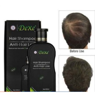 (Dexe) Organic Hair Growth Anti-Hair Loss Shampoo/ Hair Grower Shampoo