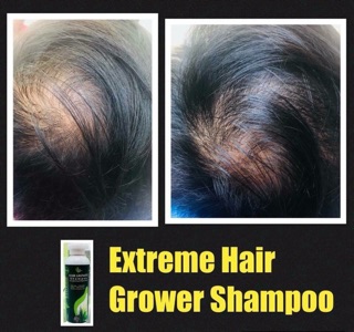 EXTReme Hair Grower Shampoo (8)