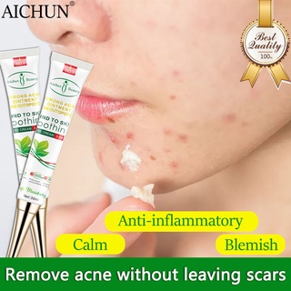 Aichun Herbal Acne Treatment Cream 30ML,Repair Acne scar remover Acne scar treatment cream pimples