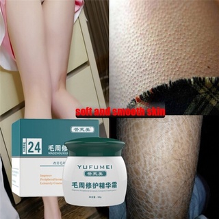 50g Keratosis Pilaris Cream Body Lotion Skin Repair Cream Skin Care Essence Moisturizing And Nourishing