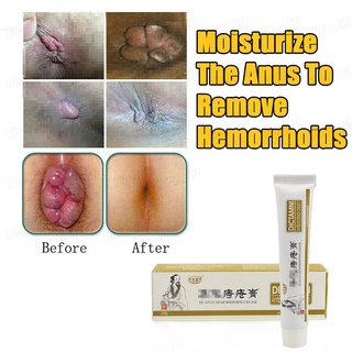 Hua Tuo Hemorrhoids Ointment Hemorrhoids Treatment Ointment Cream Health Care Hemorrhoid Cream(20g) (2)