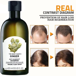 The Body Shop Ginger Shampoo Hair Care Anti [Dandruff Hair Loss] Control Oil Relieve Itching Scalp (6)