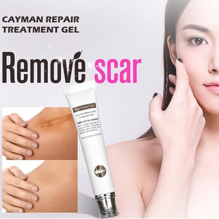 ❖✉✵VG scar removal Acne Cream Scar Cream Scars Repair Stretch Marks Pregnancy Scars Scalded Surgery (3)