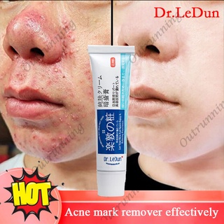 Dr.LeDun Pimple Remover Cream Acne Mark Remover Skin Care Products Anti Acne Treatment 18g