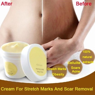moisturizer❅Remove Scar Stretch Marks Care Postpartum Skin Body Repair