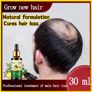 Hair Loss Treatment Hair Loss Shampoo Prevent Hair Loss Product Hair Growth Essential Serum Oil Sham (1)