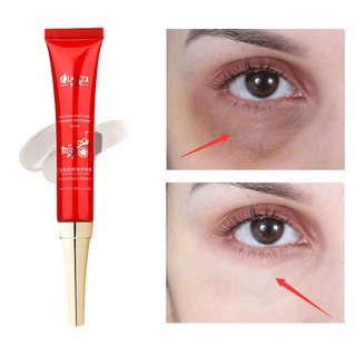 rose eye cream remove dark circle wrinkle whitening santi edema moisturizing anti aging 25g