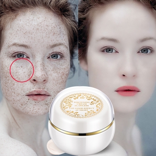 Lady Skin Cream Magic Glow Freckle Removal Whitening Cream Freckles Sunburn Plaques Of Pregnancy Remove Face Brighten