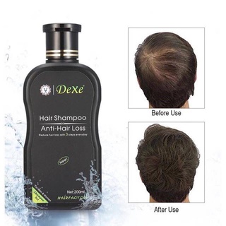 Hair Care✚❈ORIG DEXE Organic Hair Grower Anti-Hair Loss Shampoo 200ML (2)