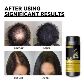8g Herbal Ginger Essence Repair Damaged Scalp Powder for Hair Growth Thickening Anti Hair Loss Hair