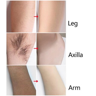 New products¤Unisex Natural Painless Smooth Permanent Hair Removal Cream Effective Body Hair Remover