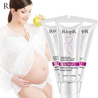 Safety . healthRtopR 3 Pieces RtopR Mango Remove Pregnancy Scars Acne Cream Stretch Marks Treatment